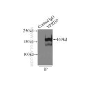 VPRBP Rabbit Polyclonal Antibody (11612-1-AP)