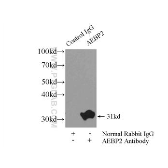 AEBP2 Rabbit Polyclonal Antibody (11232-2-AP)