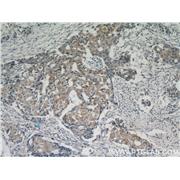 ACP5 Rabbit Polyclonal Antibody (11594-1-AP)