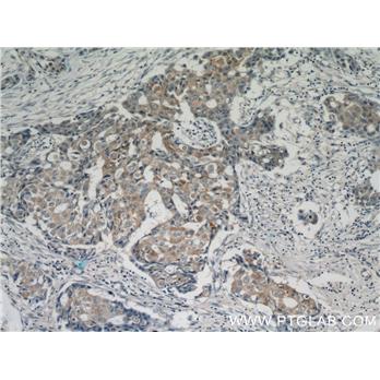 ACP5 Rabbit Polyclonal Antibody (11594-1-AP)