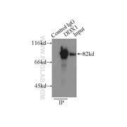 DDX1 Rabbit Polyclonal Antibody (11357-1-AP)