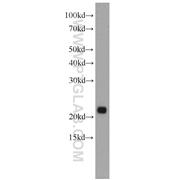 PTPMT1 Rabbit Polyclonal Antibody (11493-1-AP)