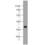 PARVA Rabbit Polyclonal Antibody (11202-1-AP)