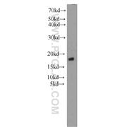 SRP14 Rabbit Polyclonal Antibody (11528-1-AP)