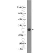 MTX2 Rabbit Polyclonal Antibody (11610-1-AP)