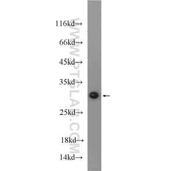 MTX2 Rabbit Polyclonal Antibody (11610-1-AP)