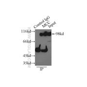 MCC Rabbit Polyclonal Antibody (11525-1-AP)
