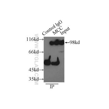MCC Rabbit Polyclonal Antibody (11525-1-AP)