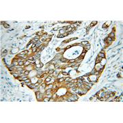 KRT81 Rabbit Polyclonal Antibody (11342-1-AP)