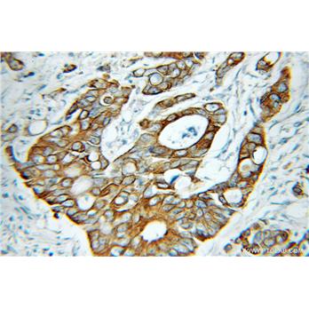 KRT81 Rabbit Polyclonal Antibody (11342-1-AP)