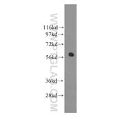 RAD23A Rabbit Polyclonal Antibody (11364-1-AP)