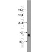 TOMM22 Rabbit Polyclonal Antibody (11278-1-AP)
