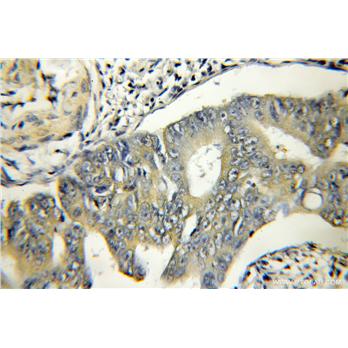 TSFM Rabbit Polyclonal Antibody (11701-1-AP)