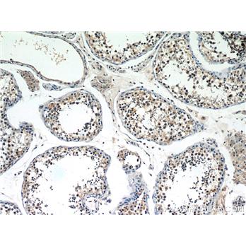 SERPINE2 Rabbit Polyclonal Antibody (11303-1-AP)