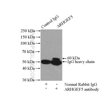 ARHGEF5 Rabbit Polyclonal Antibody (11379-1-AP)