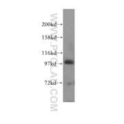 HECTD3 Rabbit Polyclonal Antibody (11487-1-AP)