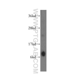 COX17 Rabbit Polyclonal Antibody (11464-1-AP)