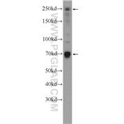 EIF4G3 Rabbit Polyclonal Antibody (11281-1-AP)