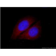 ARL5B Rabbit Polyclonal Antibody (11694-1-AP)