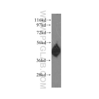 SERPINA4 Rabbit Polyclonal Antibody (11430-2-AP)