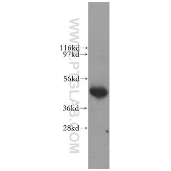 LIAS Rabbit Polyclonal Antibody (11577-1-AP)
