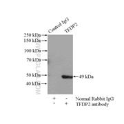TFDP2 Rabbit Polyclonal Antibody (11500-1-AP)