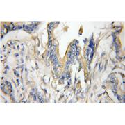 RAB1A Rabbit Polyclonal Antibody (11671-1-AP)