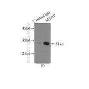 MTAP Rabbit Polyclonal Antibody (11475-1-AP)