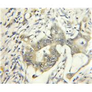 BUB1B Rabbit Polyclonal Antibody (11504-2-AP)