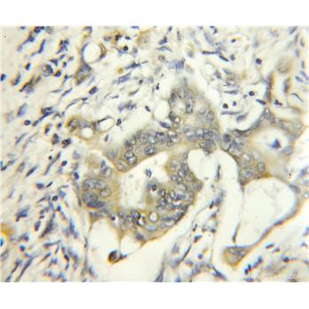 BUB1B Rabbit Polyclonal Antibody (11504-2-AP)