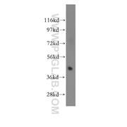 SEPT1 Rabbit Polyclonal Antibody (11370-1-AP)