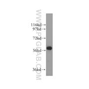 ALDH4A1 Rabbit Polyclonal Antibody (11604-1-AP)