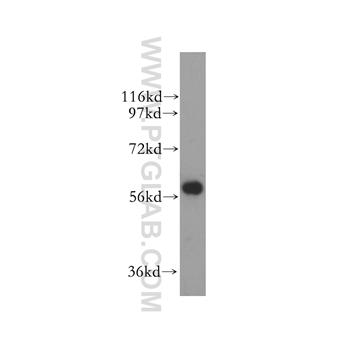 ALDH4A1 Rabbit Polyclonal Antibody (11604-1-AP)