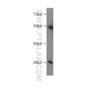 SUV39H2 Rabbit Polyclonal Antibody (11338-1-AP)