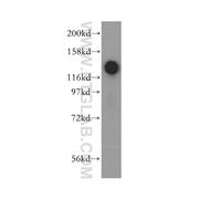 SAFB2 Rabbit Polyclonal Antibody (11642-1-AP)