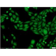 SSB Rabbit Polyclonal Antibody (11720-1-AP)