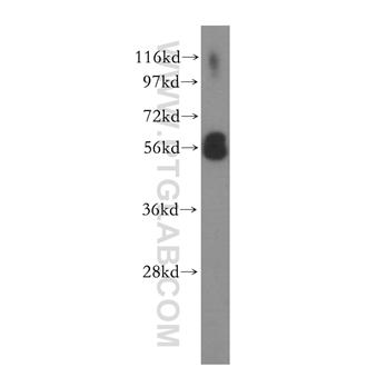 MCRS1 Rabbit Polyclonal Antibody (11362-1-AP)