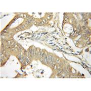 YME1L1 Rabbit Polyclonal Antibody (11510-1-AP)