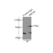 ABCD1 Rabbit Polyclonal Antibody (11159-1-AP)