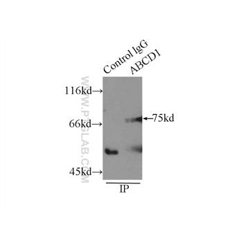 ABCD1 Rabbit Polyclonal Antibody (11159-1-AP)