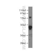 SNX4 Rabbit Polyclonal Antibody (11506-1-AP)