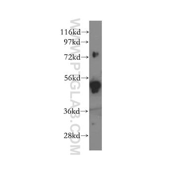 SNX4 Rabbit Polyclonal Antibody (11506-1-AP)