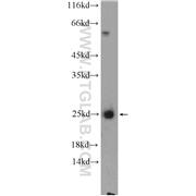 CALN1 Rabbit Polyclonal Antibody (11477-1-AP)