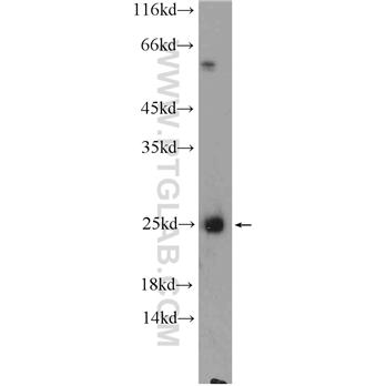 CALN1 Rabbit Polyclonal Antibody (11477-1-AP)
