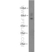 SMARCD2 Rabbit Polyclonal Antibody (11156-1-AP)
