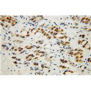 RBM4 Rabbit Polyclonal Antibody (11614-1-AP)