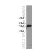 C1QA Rabbit Polyclonal Antibody (11602-1-AP)