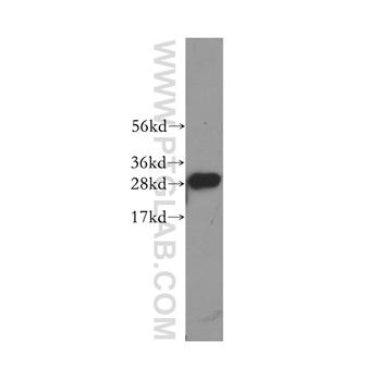 C1QA Rabbit Polyclonal Antibody (11602-1-AP)