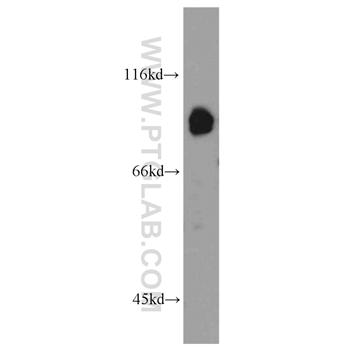 ABCB7 Rabbit Polyclonal Antibody (11158-1-AP)