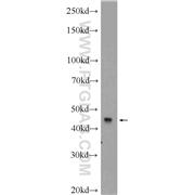 MCHR1 Rabbit Polyclonal Antibody (11656-2-AP)